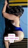 Nicol nueva Estética Realce
